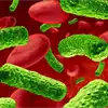 Sepsis